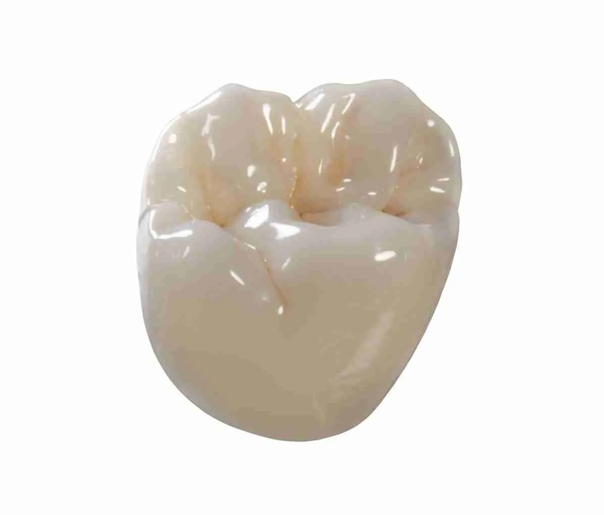 dental crown -Ocean Breeze