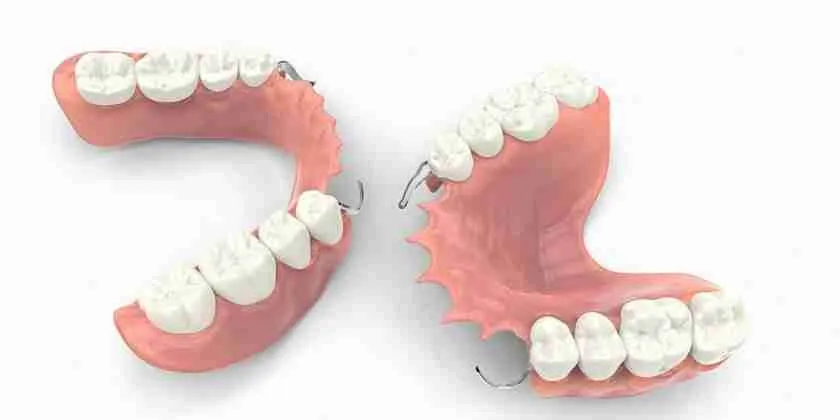 Removable Partial Dentures 1 -Ocean Breeze